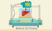Global Medical 3D Printing market