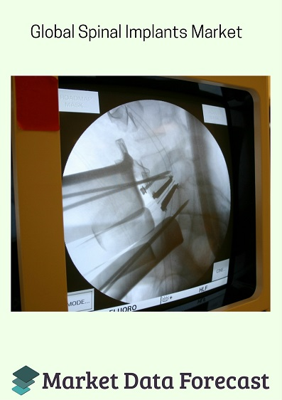 Spinal Implants Market