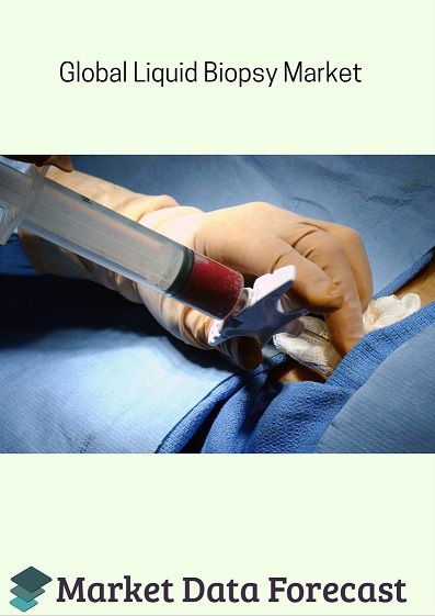 Liquid Biopsy Market