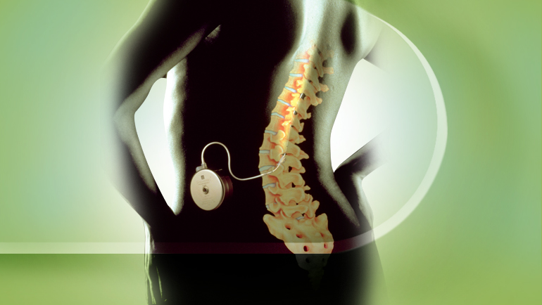 Implantable Drug Delivery Devices Market'