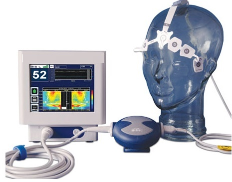Anesthesia Monitoring Devices Market - The Future of Healthc'