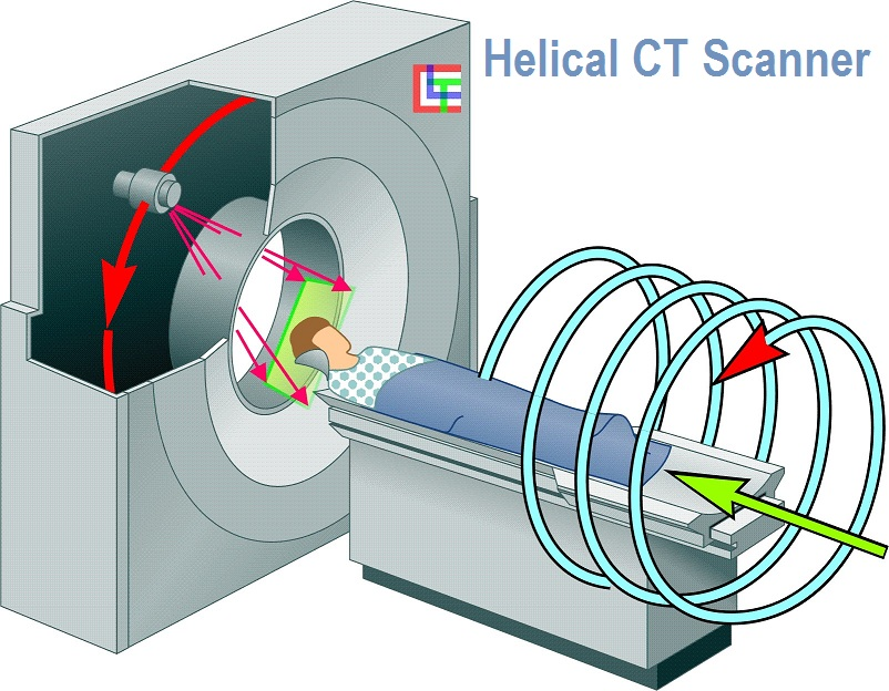 Helical CT scanners Market