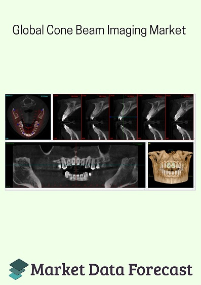 Cone Beam Imaging Market