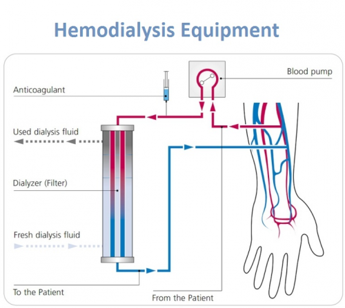 Hemodialysis Equipment Market'