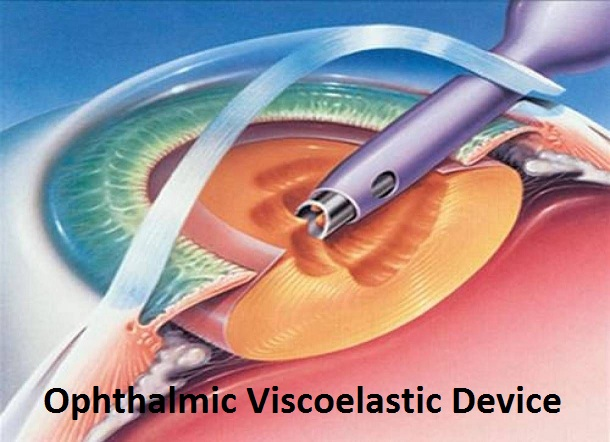 Ophthalmic Viscoelastic Device Market'