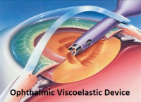 Ophthalmic Viscoelastic Device Market