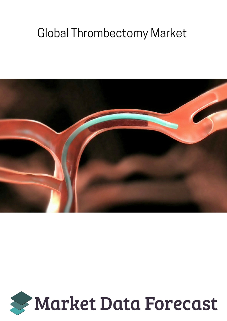 Thrombectomy Devices Market'