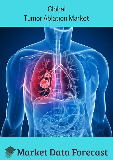 Global Tumor Ablation Market'