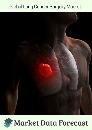 Lung Cancer Surgery Market