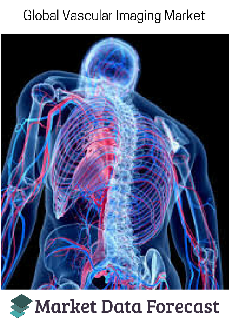 Vascular Imaging Market