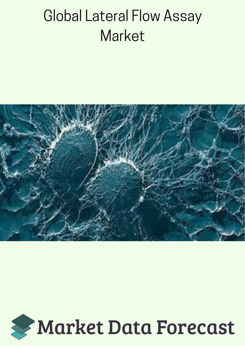 Lateral Flow Assay market on rise due to growing aged popula'