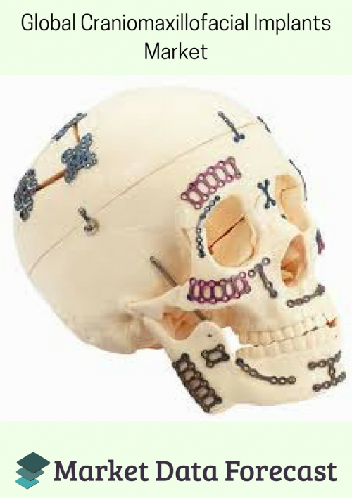 Craniomaxillofacial Implants Market'