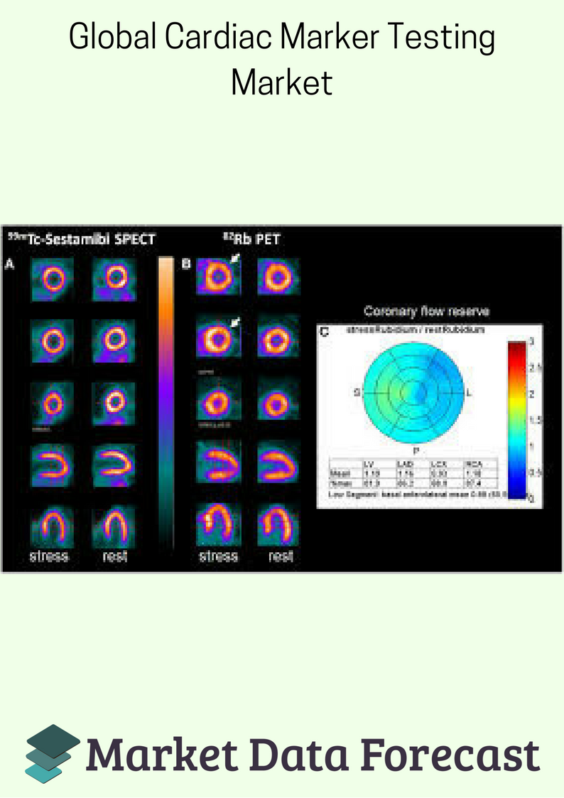 Cardiac Marker Testing Market to mark a significant increase'