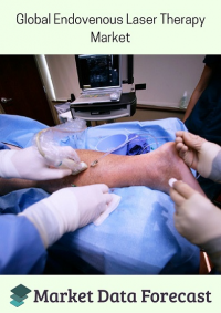 Global Endovenous Laser Therapy Market