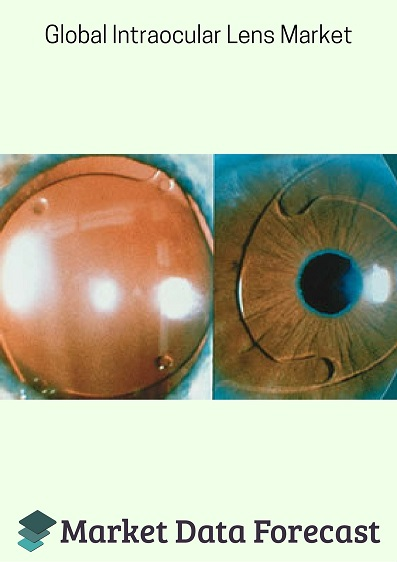 Global Intraocular Lens Market