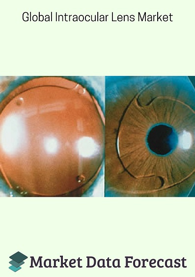 Global Intraocular Lens Market'