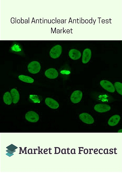 Antinuclear Antibody Test Market