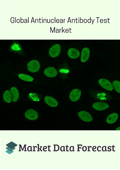 Antinuclear Antibody Test Market'