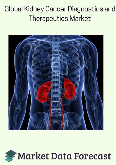 Global Kidney Cancer Diagnostics and Therapeutics Market'