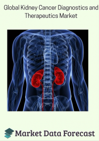 Global Kidney Cancer Diagnostics and Therapeutics Market