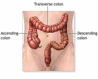 How to Find Solutions for Colon Obstruction'