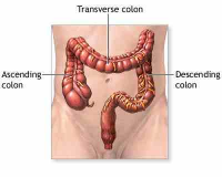 How to Find Solutions for Colon Obstruction