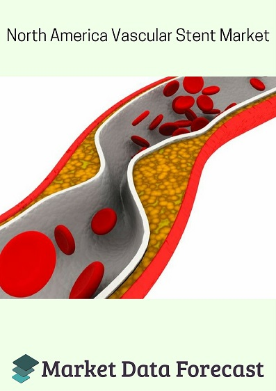 North-America Vascular Stent Market'