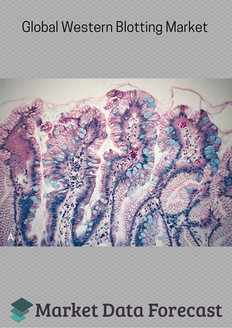 Western Blotting Market'
