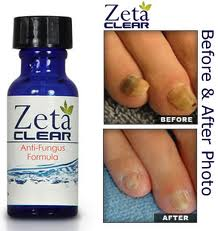 ZetaClear'