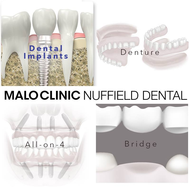 Malo Clinic Nuffield Dental'