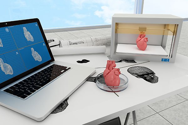 3D Printing Medical Device