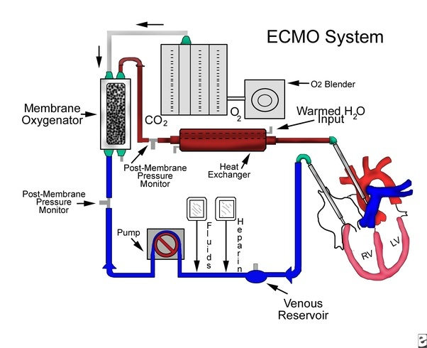 Extracorporeal Membrane Oxygenation System market