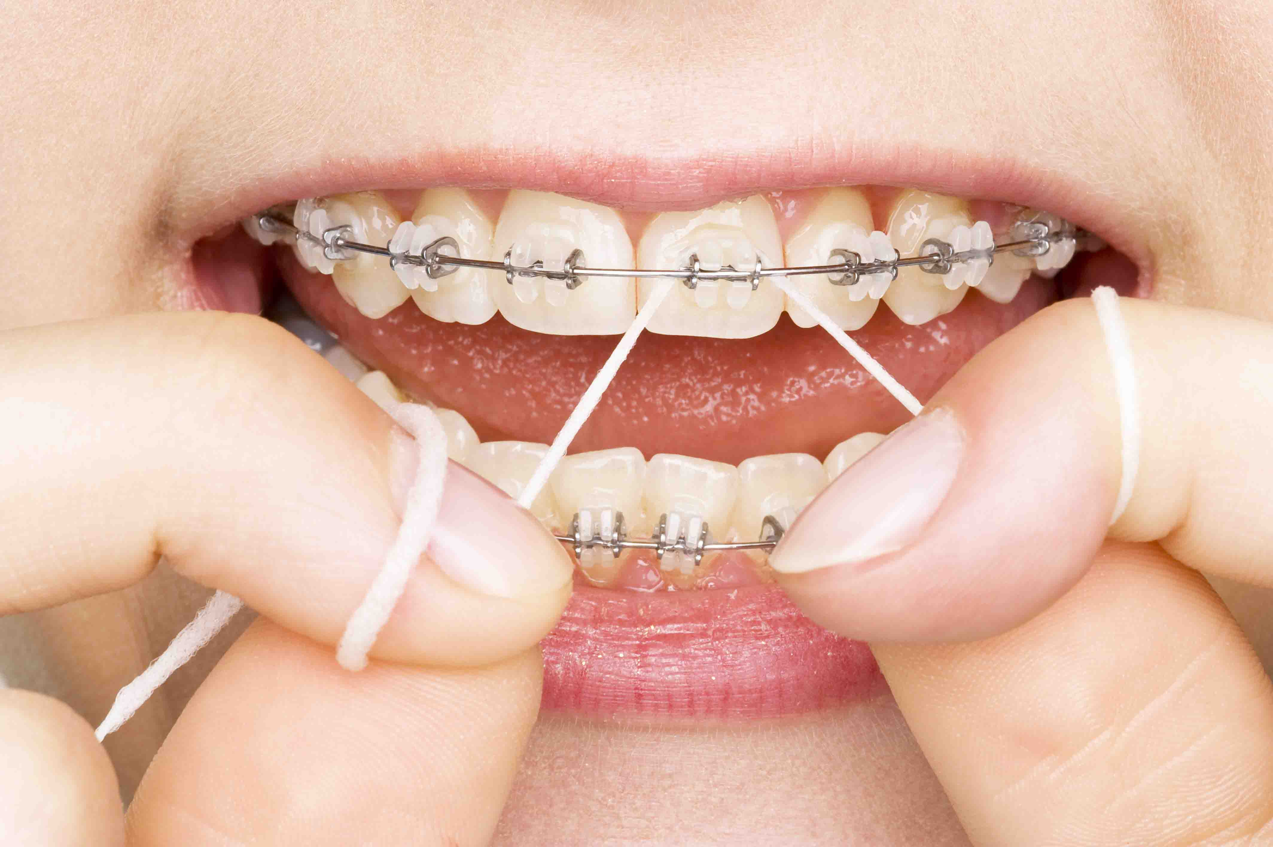 Orthodontics Market'