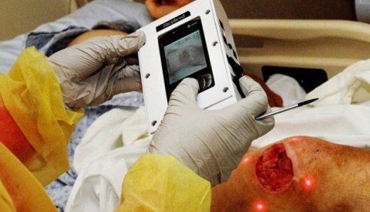 Digital Wound Measurement Devices Market'