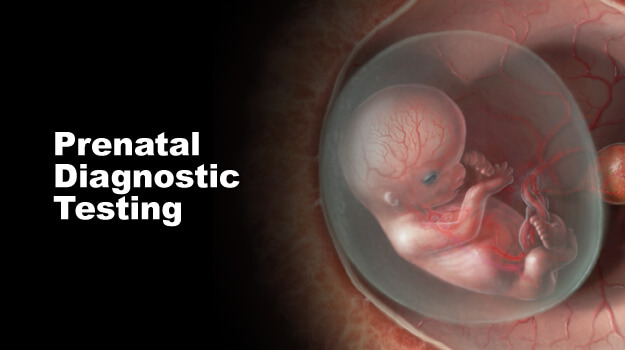 Prenatal Diagnostic market'