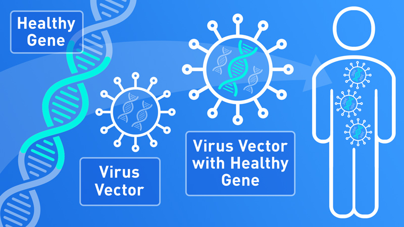 Gene Therapy'