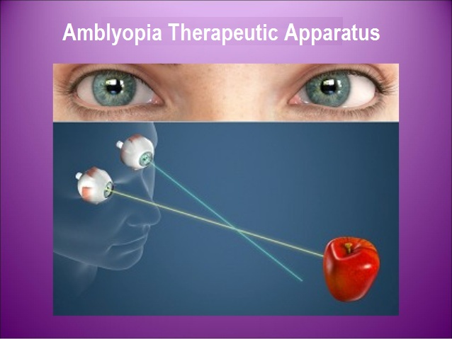 Amblyopia Therapeutic Apparatus market'