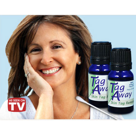 Tag Away Skin Tag Remover'