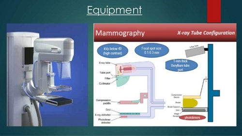 Mammography Systems Market Expected to Reach $2,648 Million,'