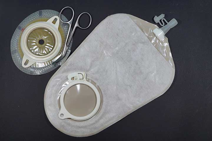 Ostomy Drainage Bags Market'