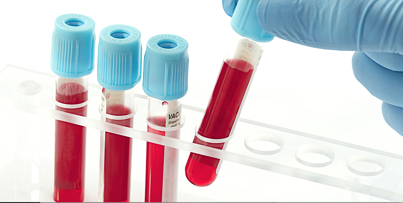 Blood Testing Technologies Market'