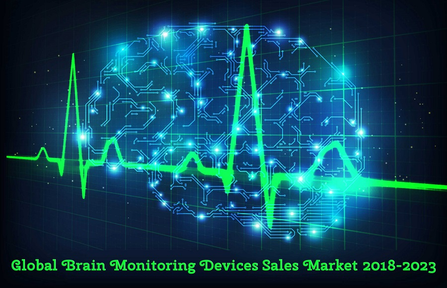 +47% CAGR to Be Achieved by IT Robotic Automation Market 201