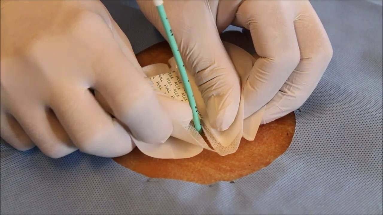 Catheter Securement Devices'