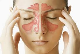 Acute Sinusitis Market'