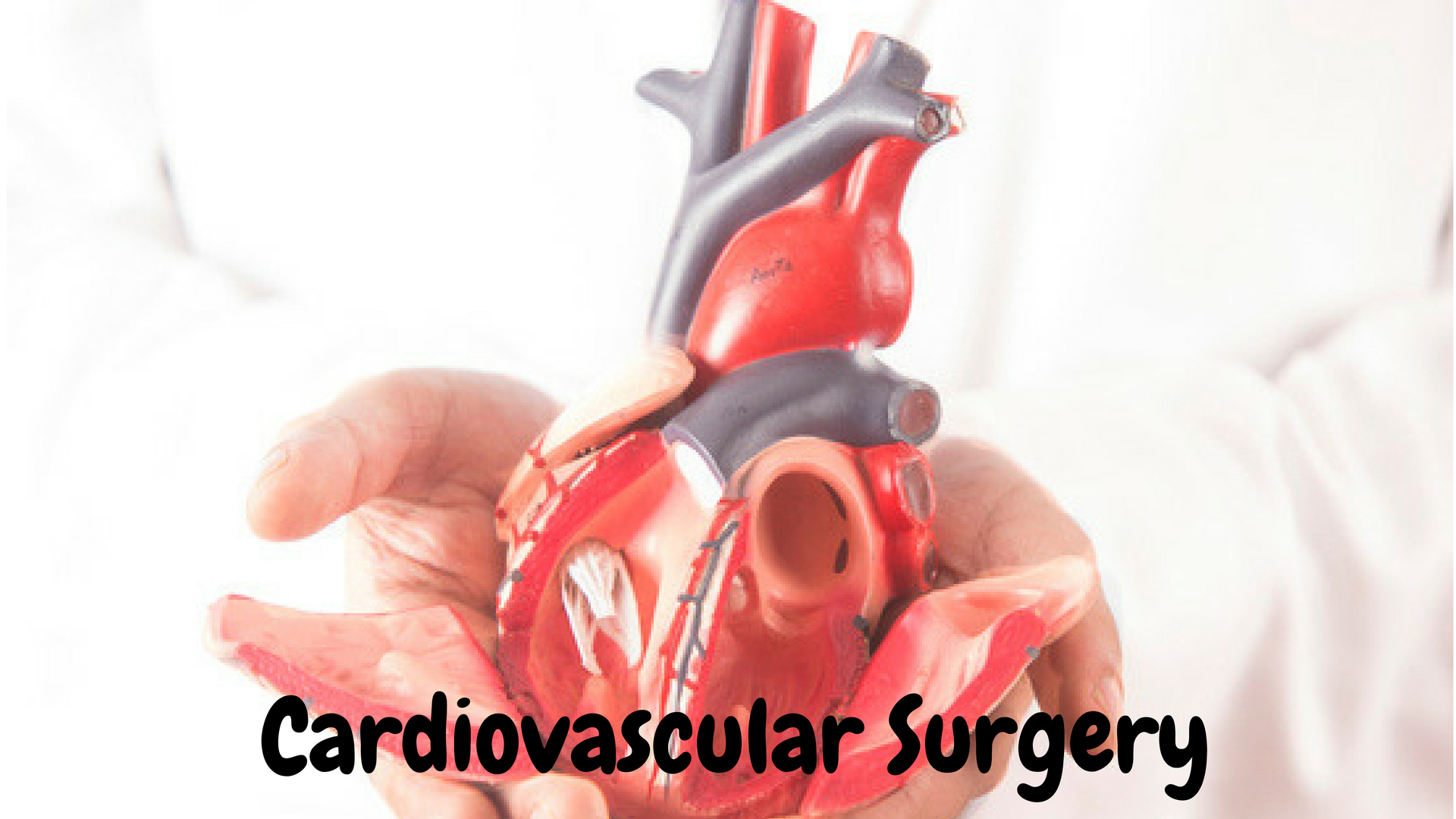 Cardiovascular Surgery'