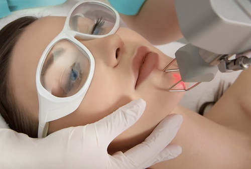 Laser Resurfacing Market'