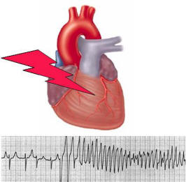 Long QT Syndrome Market'