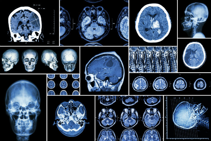 Cloud Based Medical Imaging Informatics'