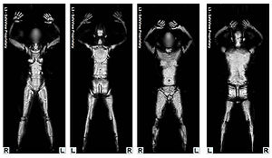 Full Body Scanner
