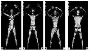 Full Body Scanner'